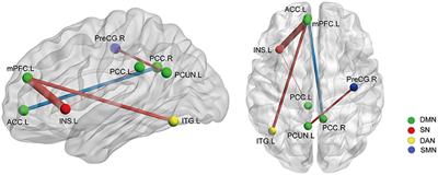 Pain- and Fatigue-Related Functional and Structural Changes in Ankylosing Spondylitis: An fRMI Study